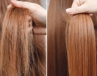 احیا و تراپی مو